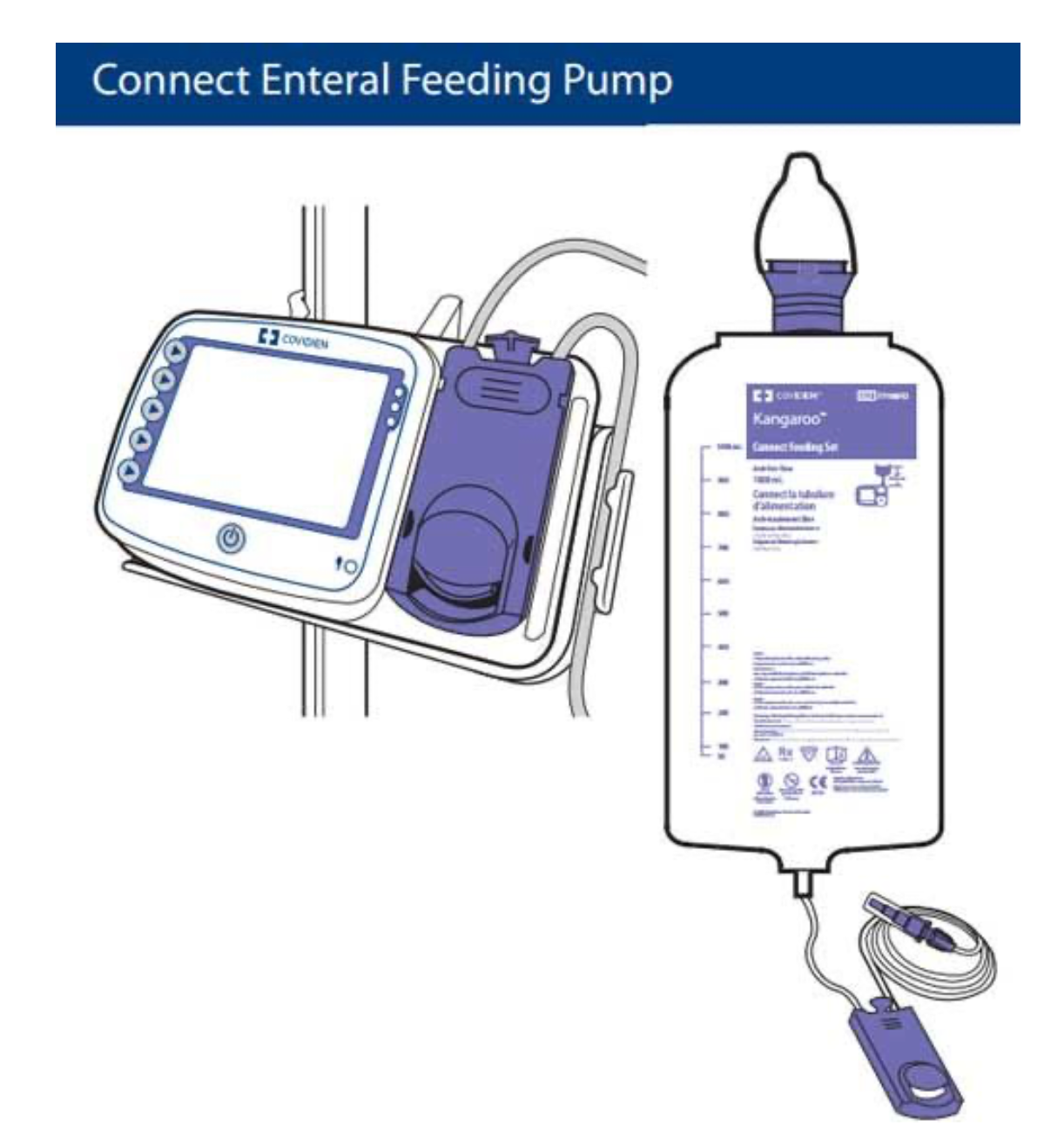 Kangaroo Connect Feeding Pump with Pole Connector